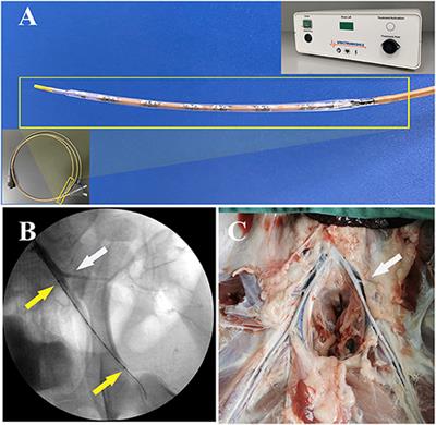 Injury and Healing Response of Healthy Peripheral Arterial Tissue to Intravascular Lithotripsy: A Prospective Animal Study